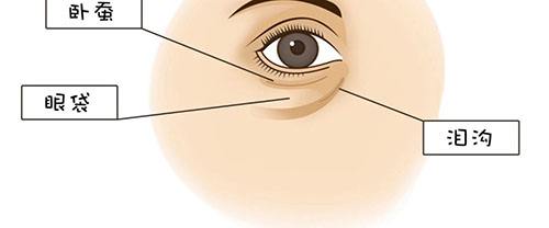 外切去眼袋手术的注意事项和护理措施