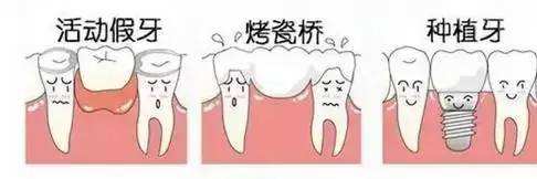2019年上海种植牙的价格表