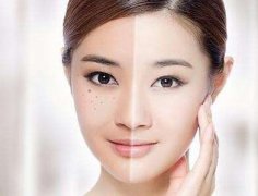激光光电整形美容方面的皮肤的护理是怎么样的
