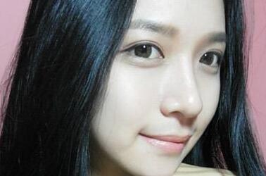 膨体隆鼻假体晃动是做失败了吗？