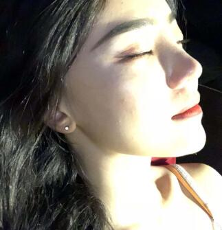 膨体隆鼻假体晃动是做失败了吗？