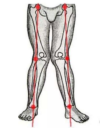 X型腿变成笔直的腿型有哪些方法？