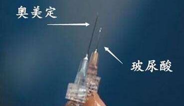 玻尿酸填充后不吸收？你可能是注射了奥美定！