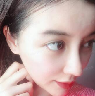 隆鼻手术怎么做？详细流程介绍一下~