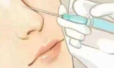 看看注射玻尿酸的副作用~你还敢注射吗？