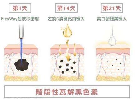 祛斑不反弹，除了激光还有什么好的办法？