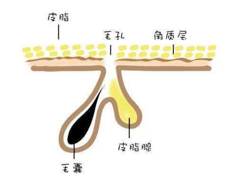有黑头应该怎么办？有的处理方法！