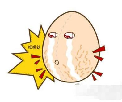 激光妊娠纹修复手术的价位！