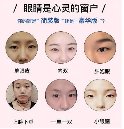 做眼部手术大概怎么收费的？一般需要多少钱？