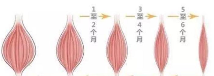 注射完注射瘦脸后需要注意那些事项？