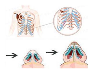 肋骨隆鼻能保持多久？