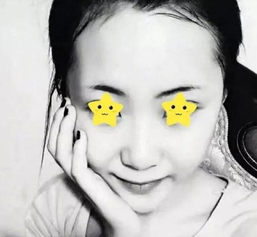【介绍】名医仇侃敏医生做的鼻部手术果真的超zan!