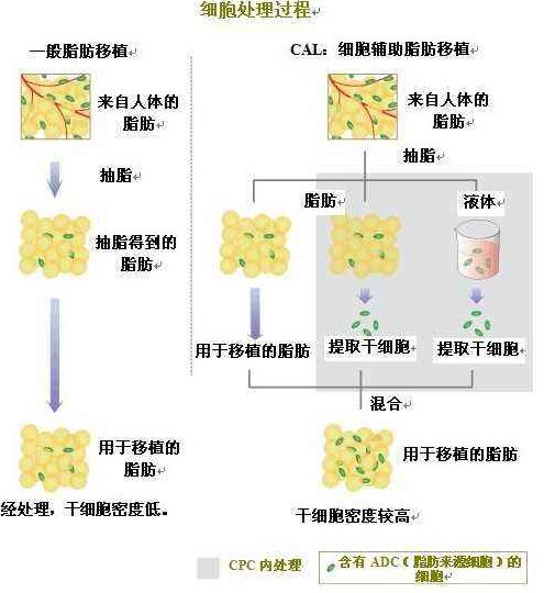 听说自体脂肪隆鼻成活率很高，忍不住去体验