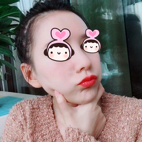 自从在萍乡丽芙整形医院做了隆鼻手术后，我也是侧颜女神了