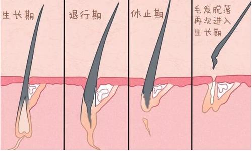 许多人关注的问题：种植的头发是否会掉？