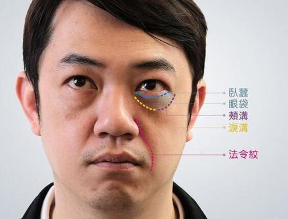 去眼袋方法这么多怎么选？4种眼袋类型调节方法有差异！
