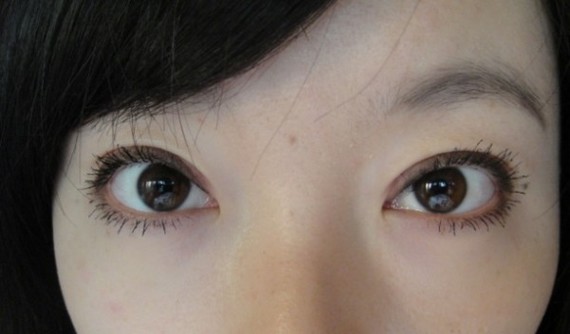 在郑州望京做了双眼皮，医生技术好评哟！