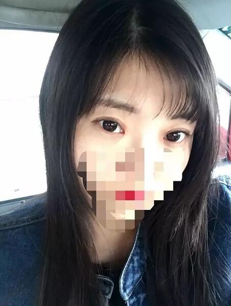 上海九院美容科双眼皮介绍，刘菲医生眼部介绍！