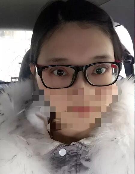 上海九院美容科双眼皮介绍，刘菲医生眼部介绍！