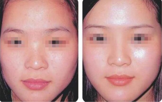 林秋蓉医生一直比较擅长的就是皮肤美容、综合祛斑、微创抗衰老等