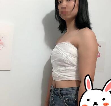 假体隆胸照片：丰胸美乳还是别寄希望于木瓜牛奶了