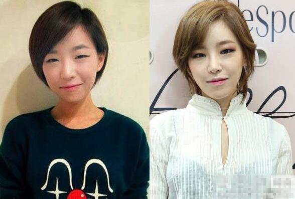 韩星孙佳仁素颜的照片 孙佳仁整容没有？
