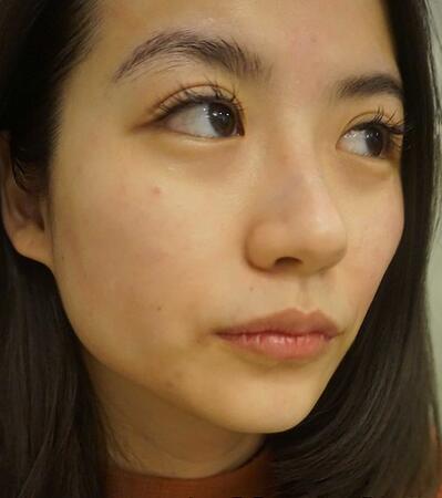 北京京通医院整形美容中心，附祛斑介绍