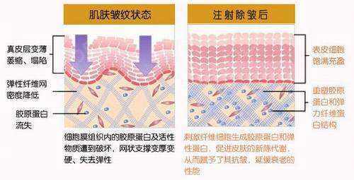 胶原蛋白祛皱果好不好？你还在为皱纹烦恼吗~