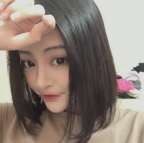 【介绍】上海鲁南做鼻部手术怎么样？历时2个月终于恢复漂亮了