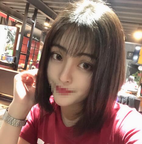 【介绍】上海鲁南做鼻部手术怎么样？历时2个月终于恢复漂亮了