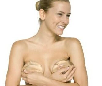 年轻女性隆胸建议做水滴型假体隆胸，术后果较为好！