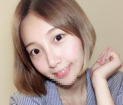 合肥褚燕军祛眼袋介绍，别留着你的眼袋过新年！