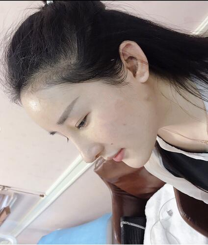【介绍】郑东学做鼻子怎么样？介绍揭晓答案