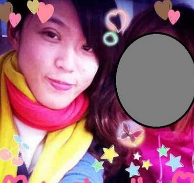 广州艾尚美医疗美容院，附埋线双眼皮介绍