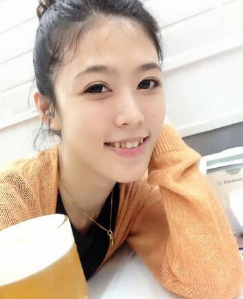 广州艾尚美医疗美容院，附埋线双眼皮介绍