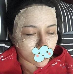 面部全脸填充填坏了能复原吗？可以做修复吗？