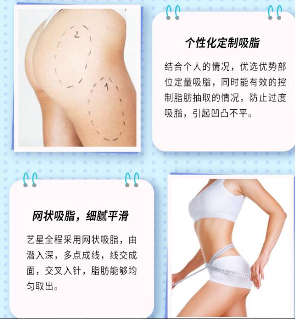 大腿臀部吸脂手术医院哪家好？需要去公立医院吗？