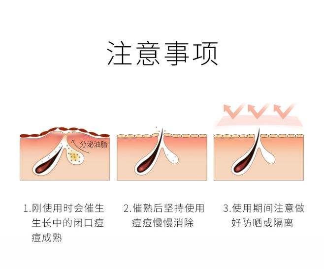 水杨酸祛痘痘、痘印真的有果吗？敏感肌我劝你别尝试！