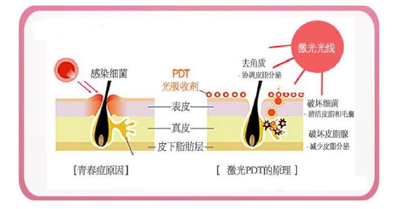 水杨酸祛痘痘、痘印真的有果吗？敏感肌我劝你别尝试！