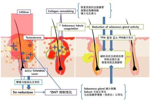 水杨酸祛痘痘、痘印真的有果吗？敏感肌我劝你别尝试！