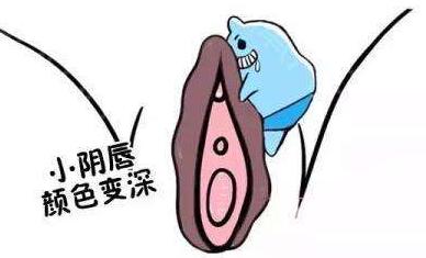 阴唇漂红有吗？手术原理+术后果