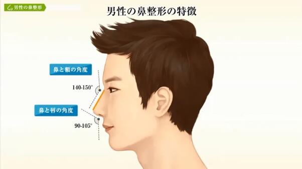 男性过大下颌角+鼻部整形改变后，颜值也能璨如天星！