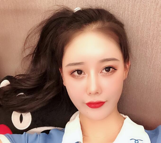下颌角磨骨术恢复期的详细经历及术后感受，大公开！