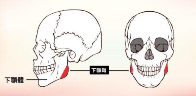 下颌角截骨术有这些危害！