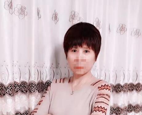 上眼皮松弛切除手术多少钱？术后你品一品