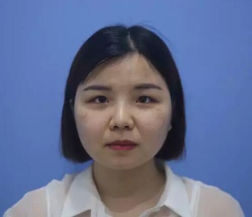 郑州风信子整形医院祛斑介绍分享~附激光美容