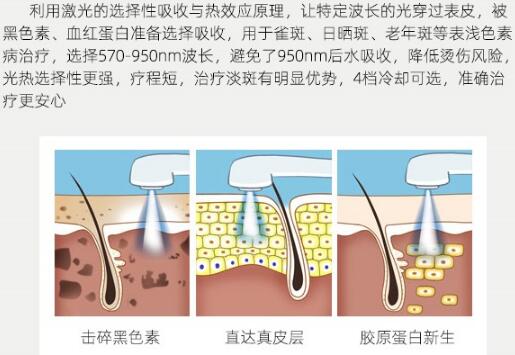 彩光美白嫩肤价格曝光，去黑头收毛孔so easy！