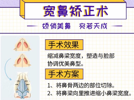 鼻梁缩窄