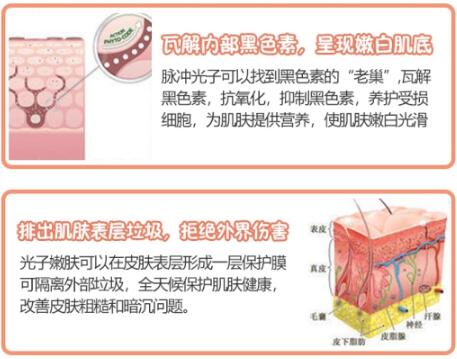 oe光子嫩肤果这么好，竟然白菜价！小姐姐满意哭了~