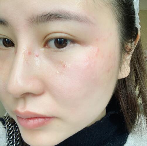oe光子嫩肤果这么好，竟然白菜价！小姐姐满意哭了~